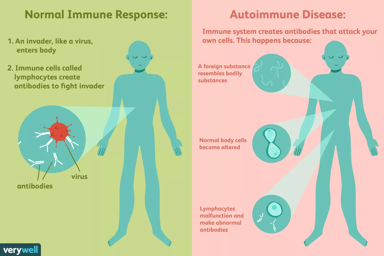 Autoimmune disease v. normal response - Credit: Verywellhealth