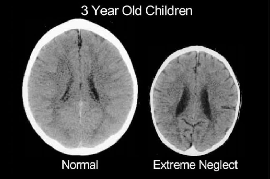 Attachment and trauma – Credit: The Growing Heart